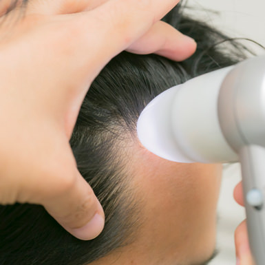 男女の薄毛治療